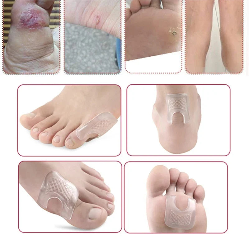 Pexmen 2/4Pcs Waterproof Toe Cushions U-Shaped Gel Callus Pads from Rubbing Reusable Foot Corn Sticker Calluses Protector